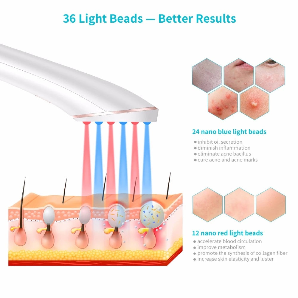 Acne Light Therapy Xpreen Wireless Rechargeable Light - Hillery's Products & Services